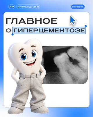 Гиперцементоз: компенсаторная реакция или патология?